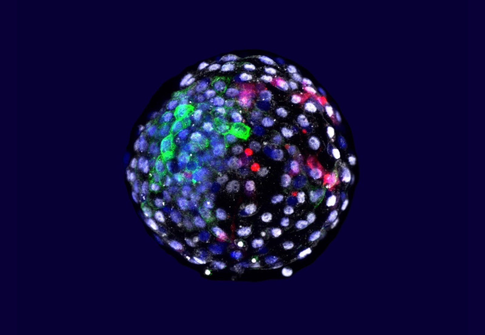 La capacidad de cultivar células de una especie dentro de un organismo de otra especie diferente ofrece a los científicos una poderosa herramienta para la investigación y la medicina, y ahora, un equipo liderado por el español Juan Carlos Izpisúa, ha logrado avances en este En la imagen, visualización mediante fluorescencia de las células de las diferentes especies en una etapa embrionaria temprana. En rojo, las células humanas. EFE/Kunming University of Science and Technology/