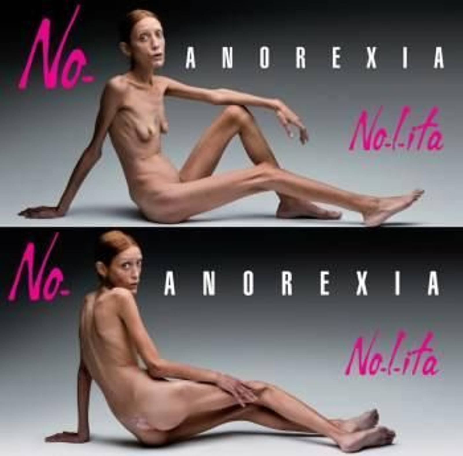 Isabelle Caro en una campaña publicitaria contra la anorexia