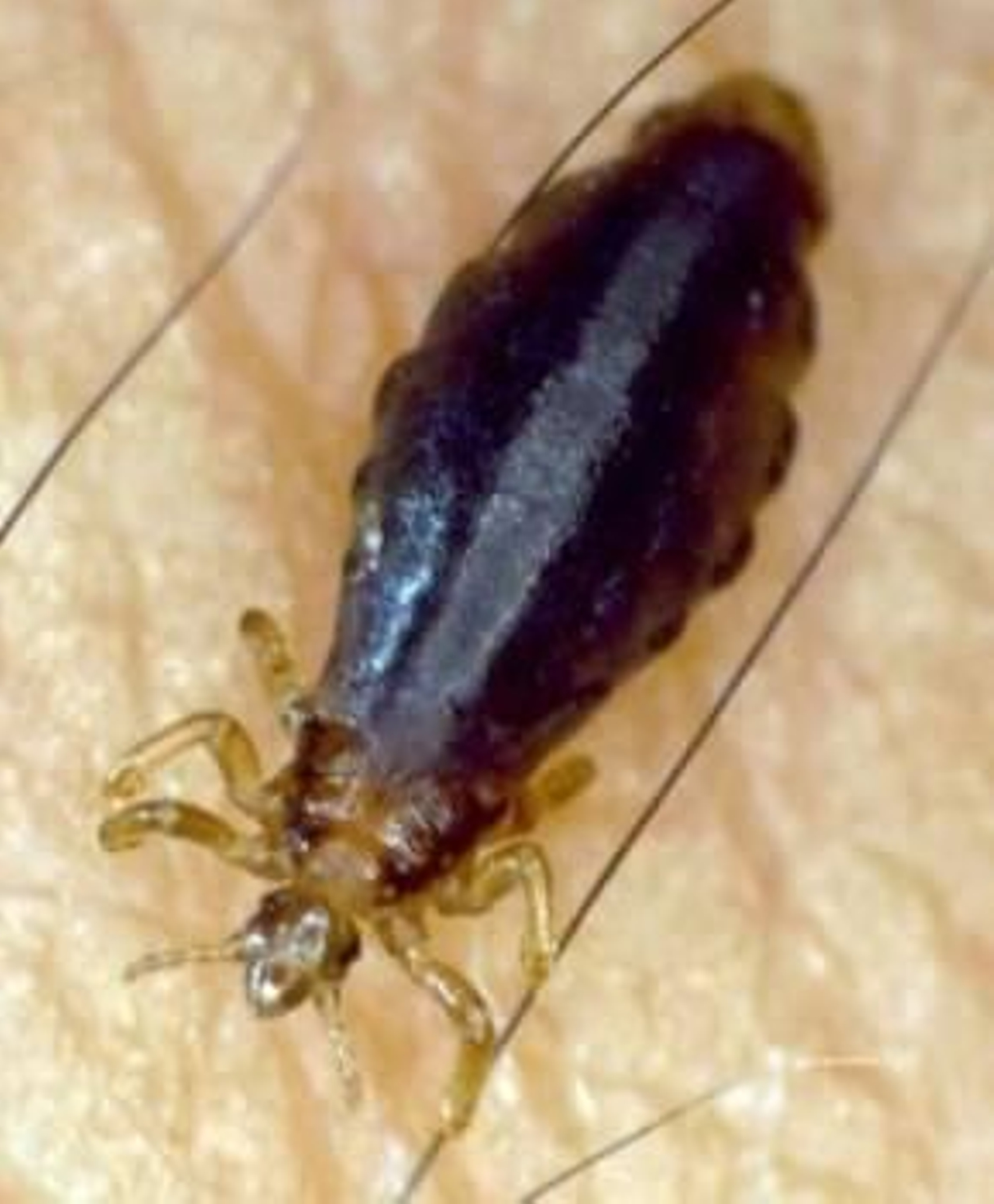 Hembra del piojo chupador de la especie 'Pediculus humanus corporis'  (Foto: Archivo EFE)