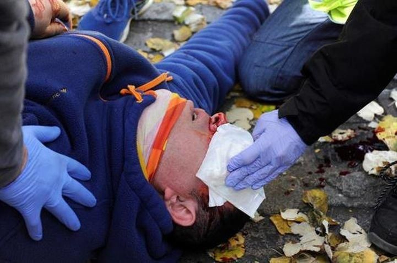 Un herido durante las protestas en Girona.
