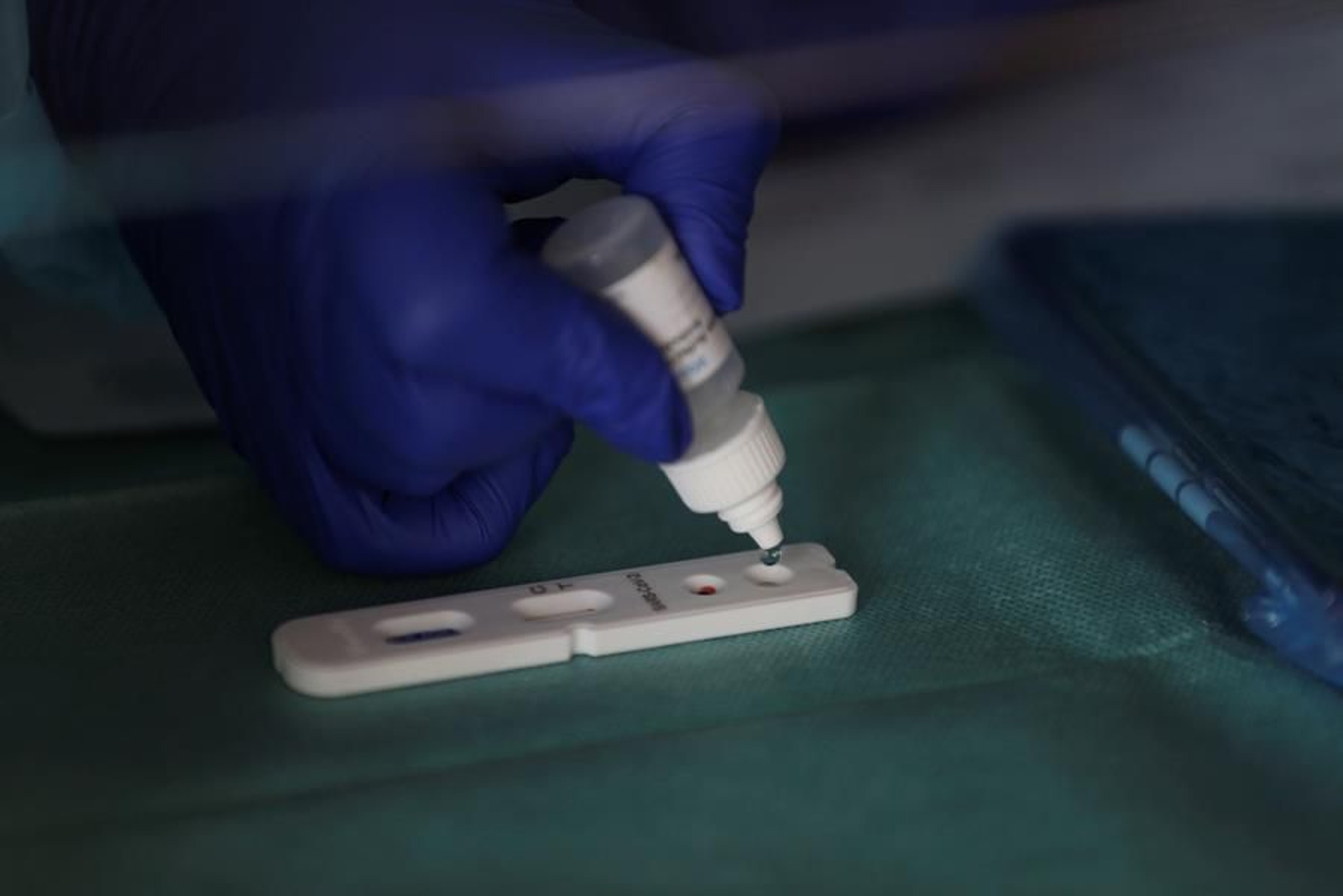 Una prueba serológica para detectar el covid (EFE).