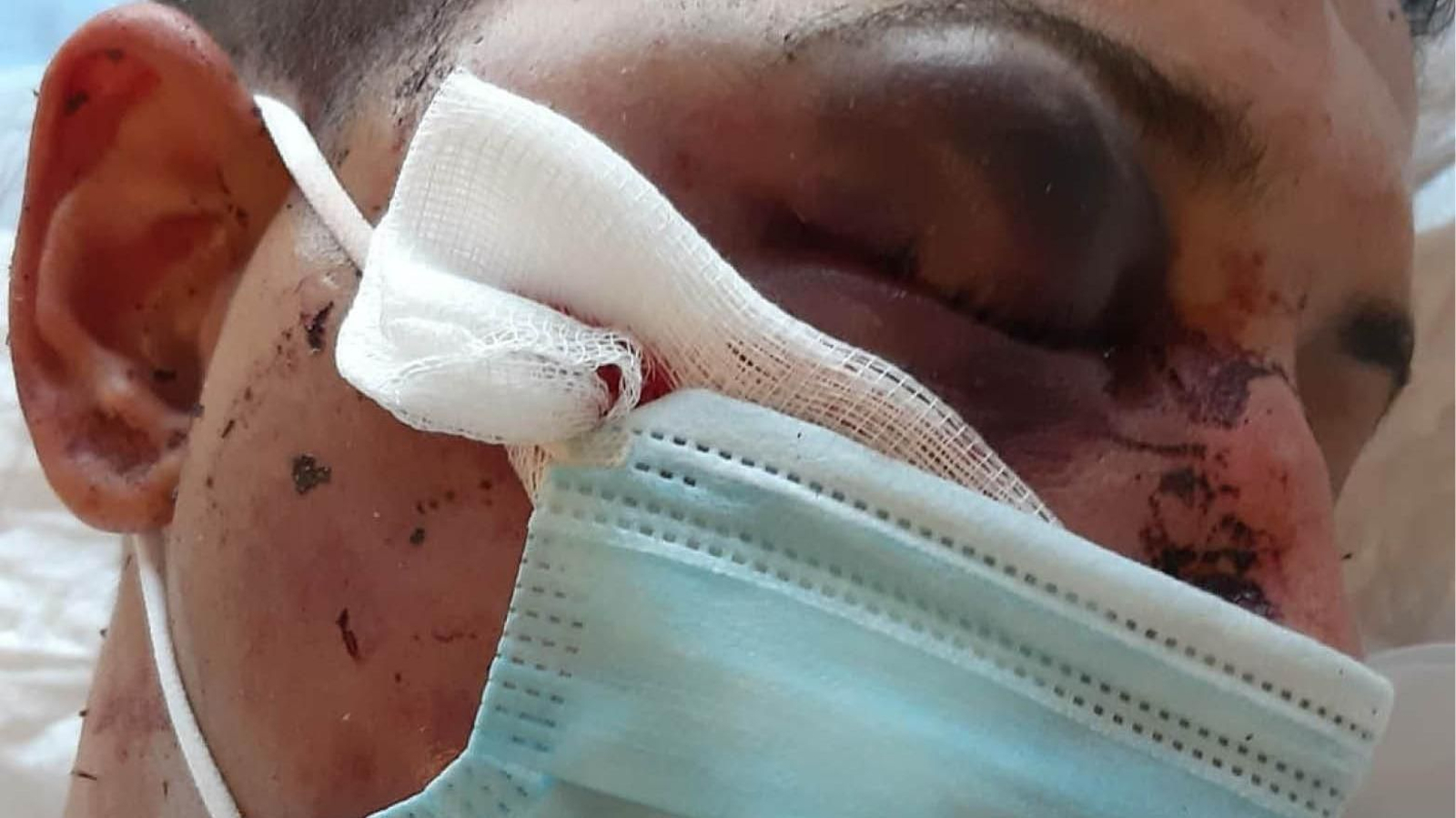 Nacho quedó semiinconsciente tras la brutal paliza.