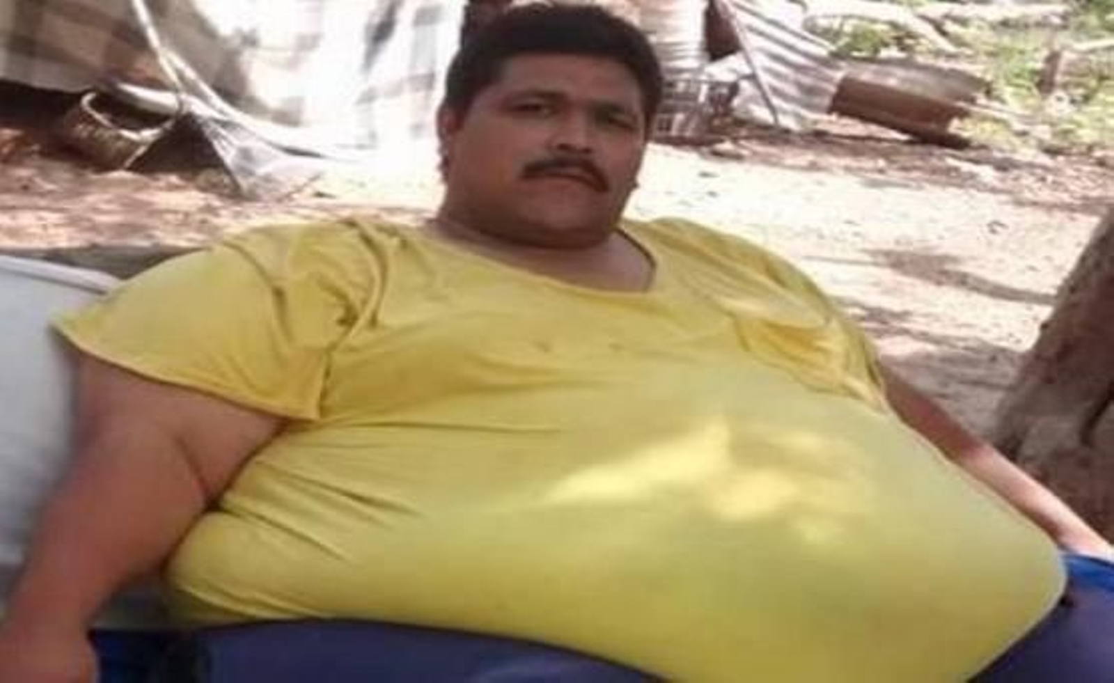 Andrés Moreno, el hombre más obeso del mundo.