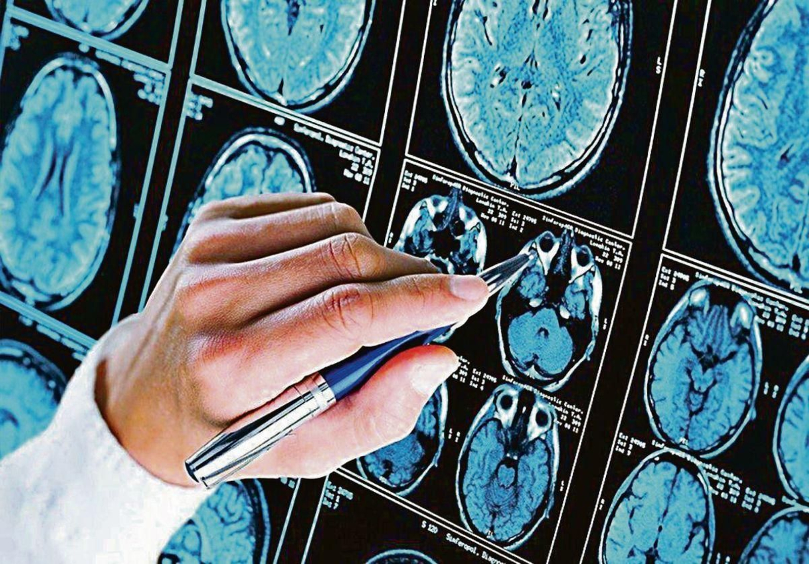 Una investigadora observa las imágenes del cerebro.