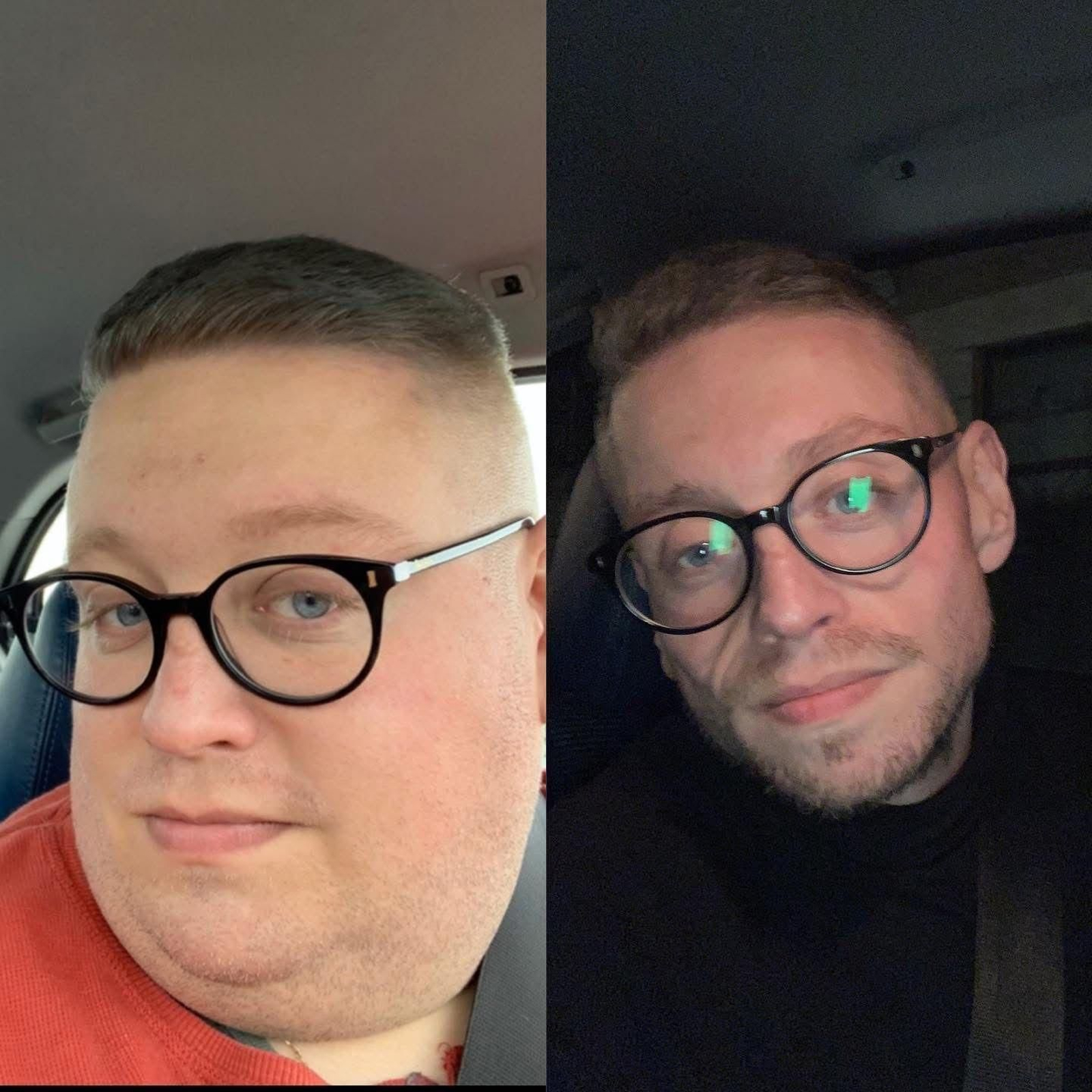 José Antonio tras perder 120 kilos aproximadamente.