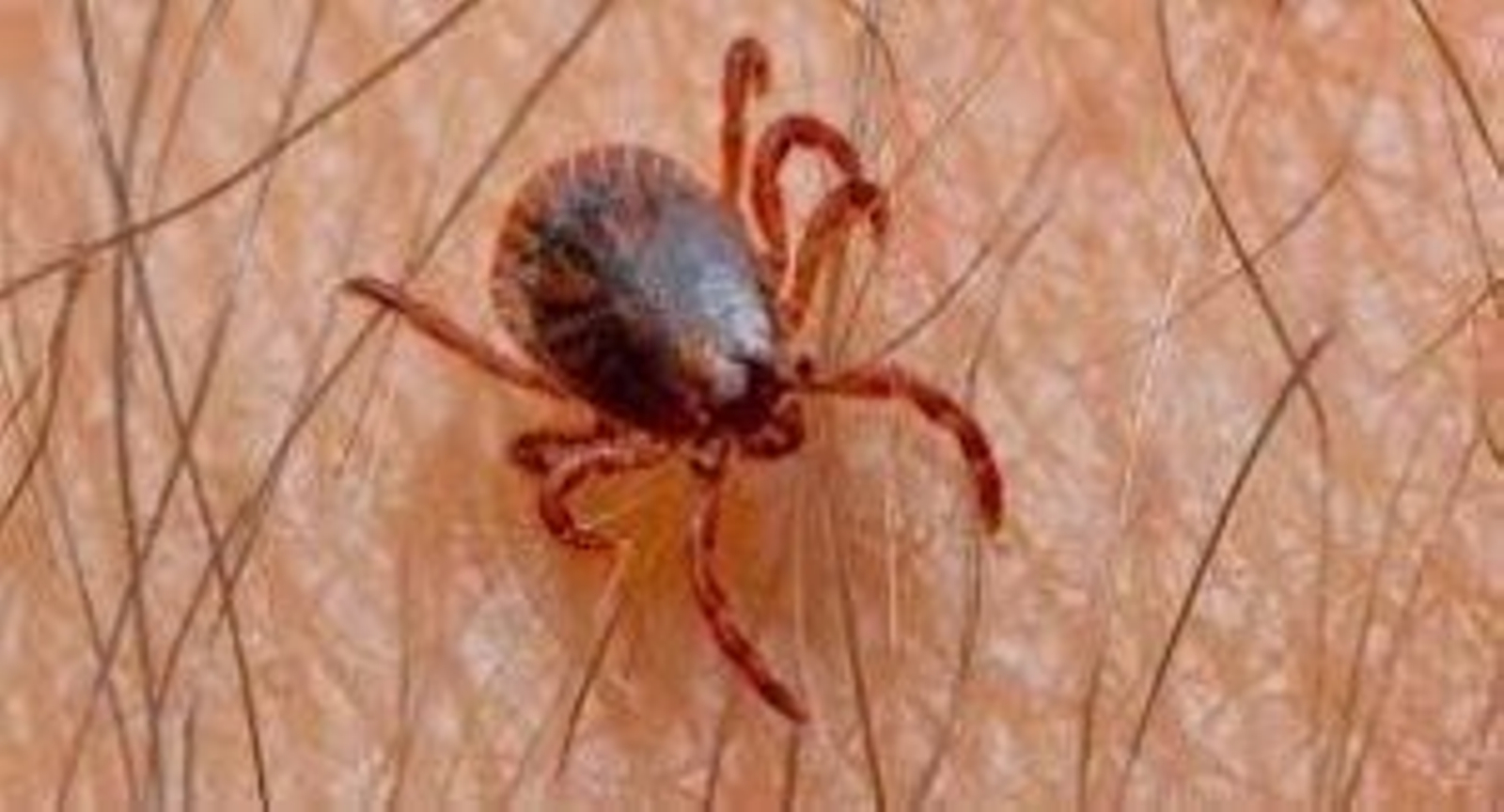 Una garrapata en un brazo.