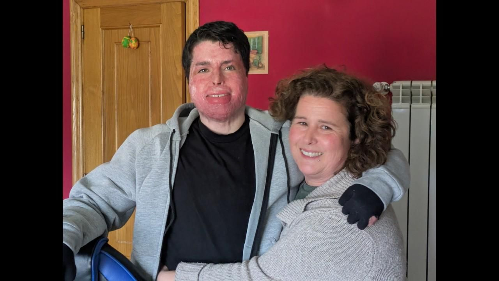 Lume. A loita de Yago