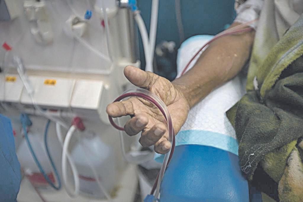 Mano de un paciente recibiendo diálisis, una terapia que reemplaza al riñón cuando falla.