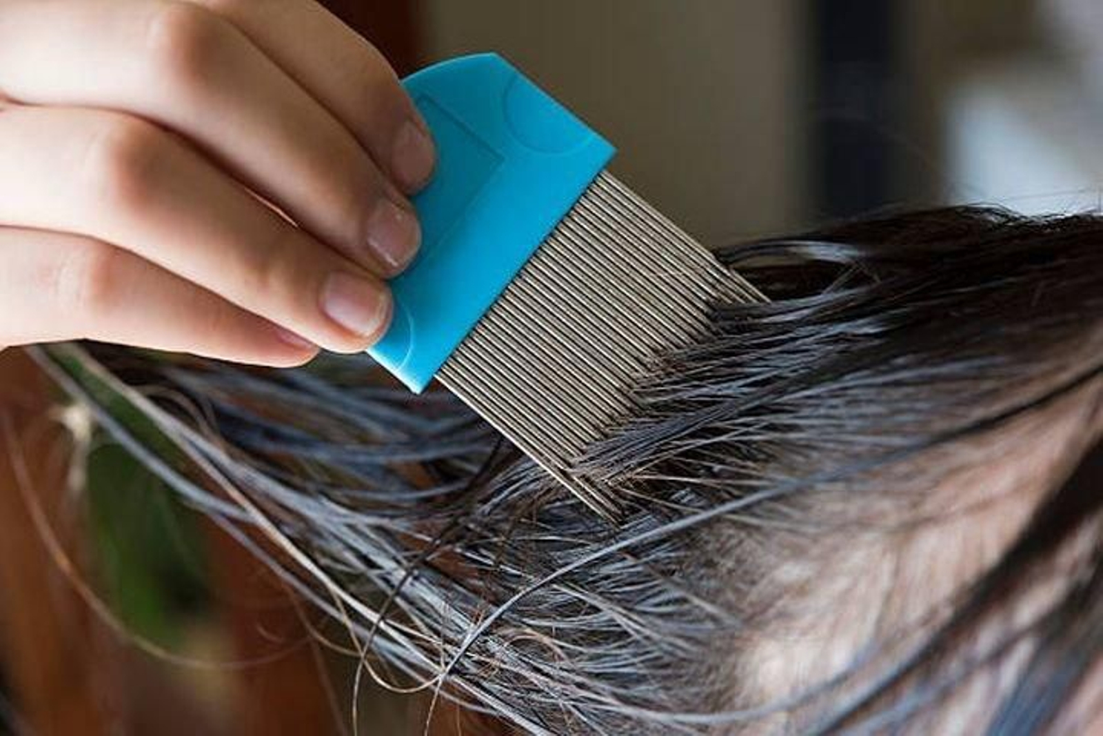 Un profesional procura eliminar los piojos con delicadeza.