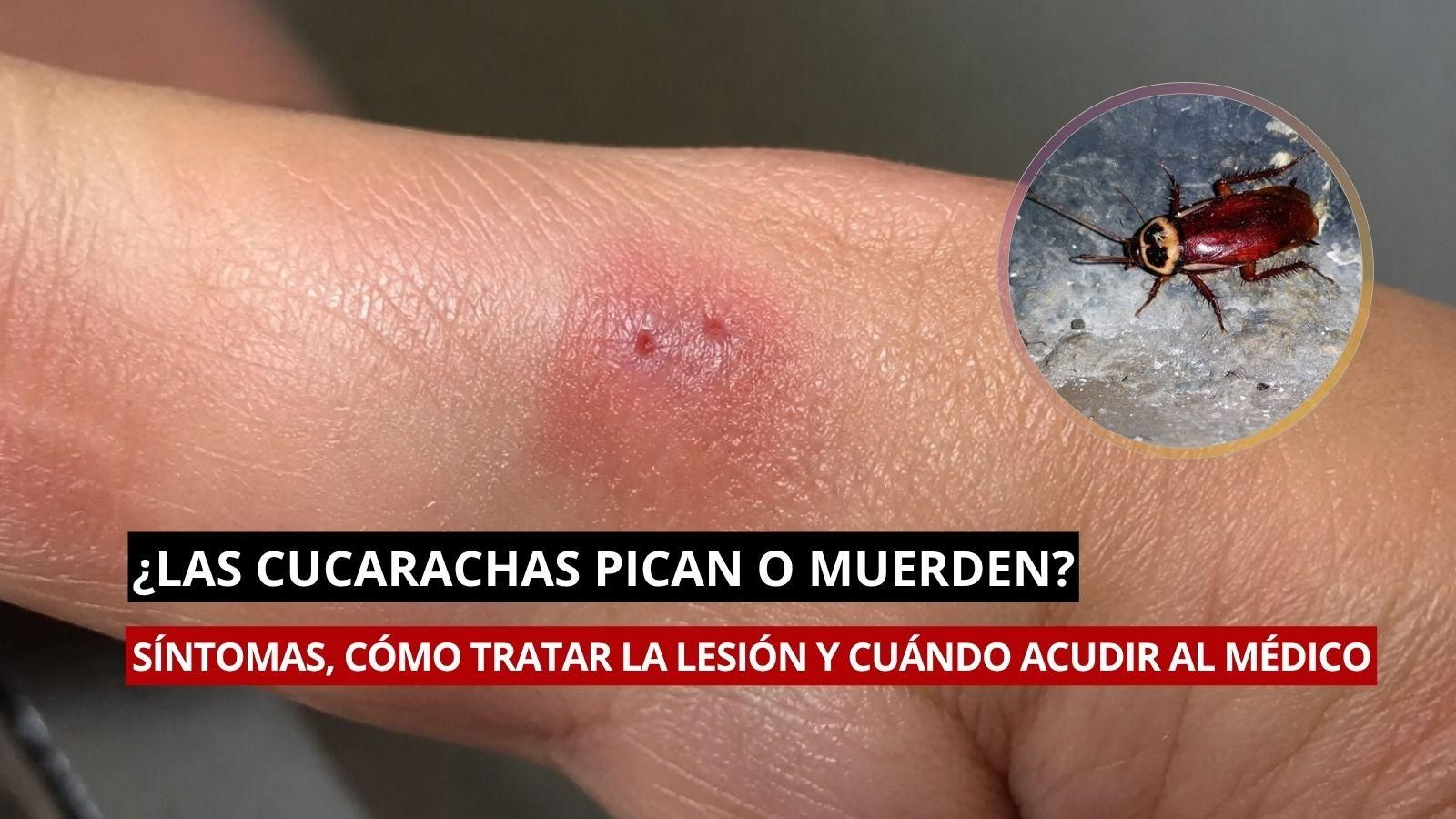Aunque las mordeduras de cucaracha son poco habituales, su presencia en el hogar sí representa un riesgo sanitario. En este artículo te explicamos cómo tratarlas.