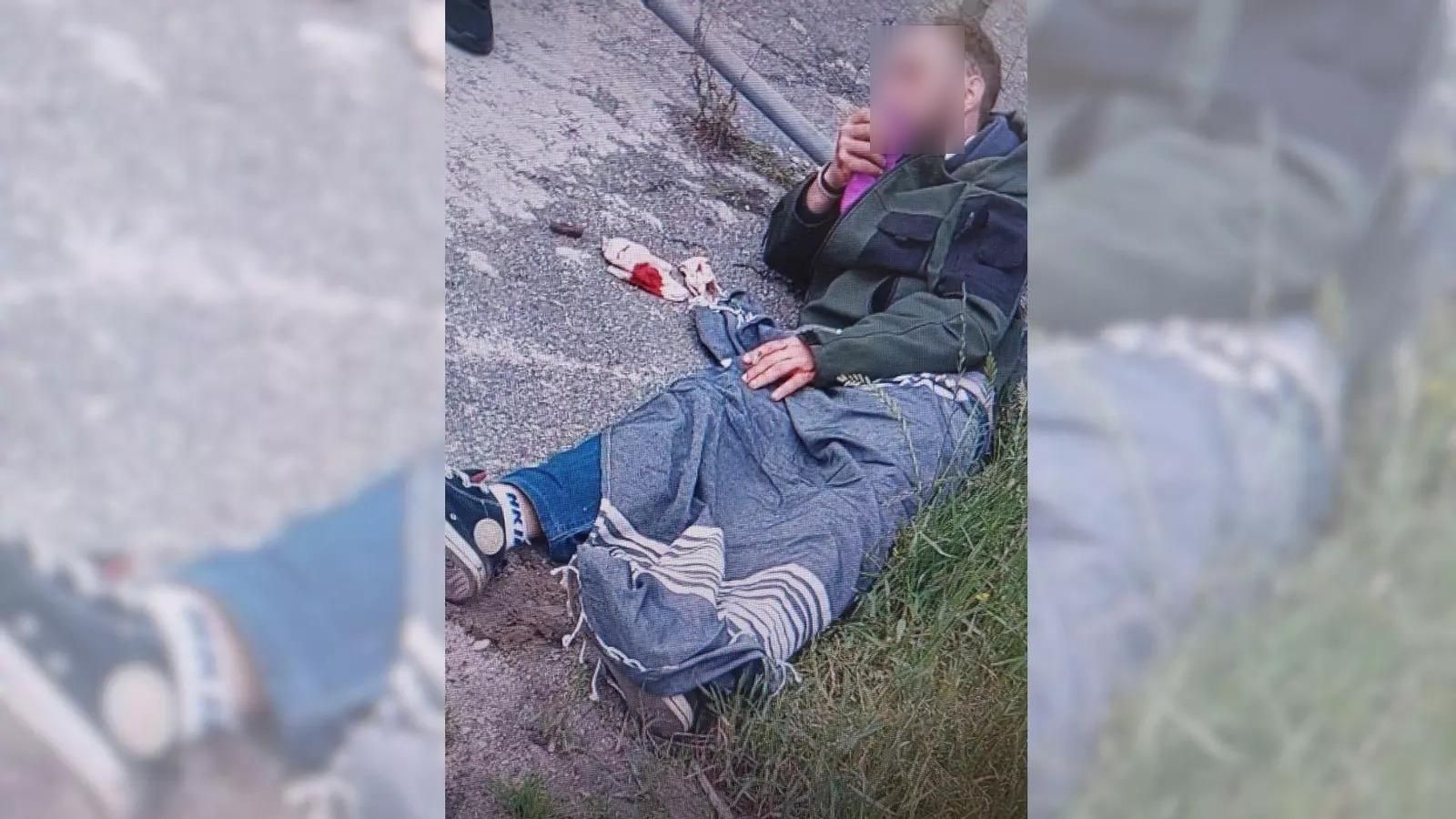El vigués al que dieron una paliza en Moaña.