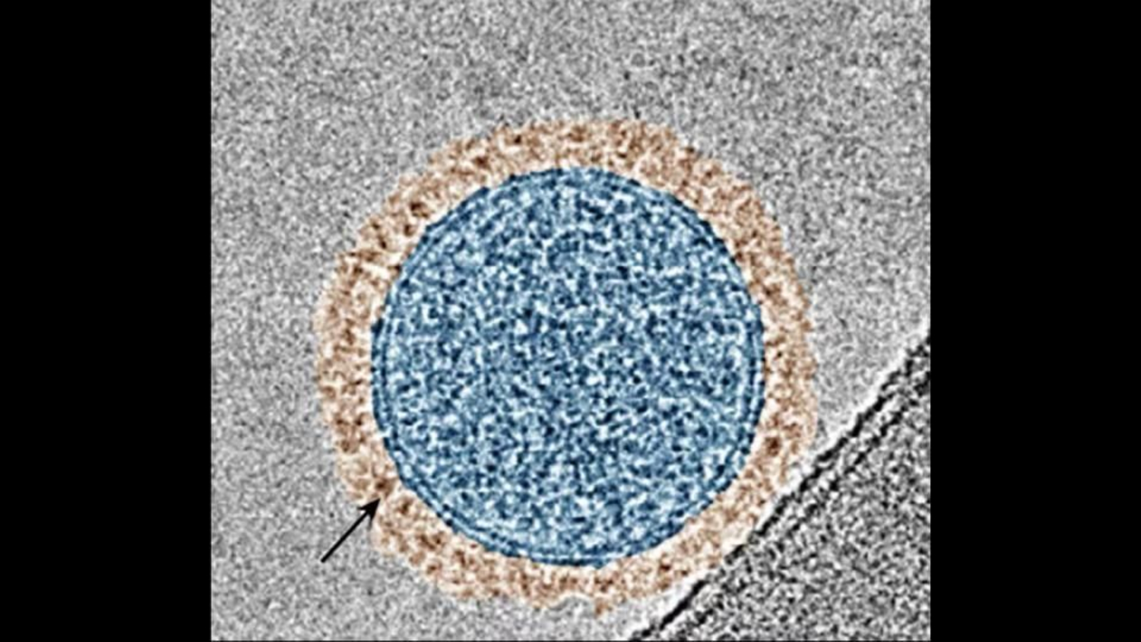 Imagen microscópica en la que puede verse un exosoma (círculo azul)