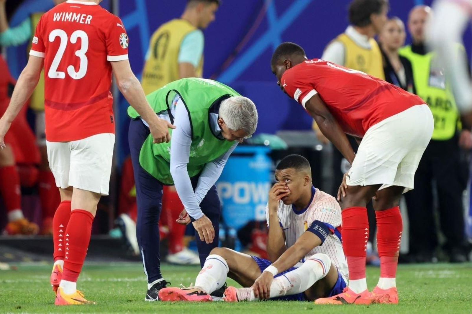 Kylian Mbappé sufrió una fractura en la nariz en el partido entre Francia y Austria.