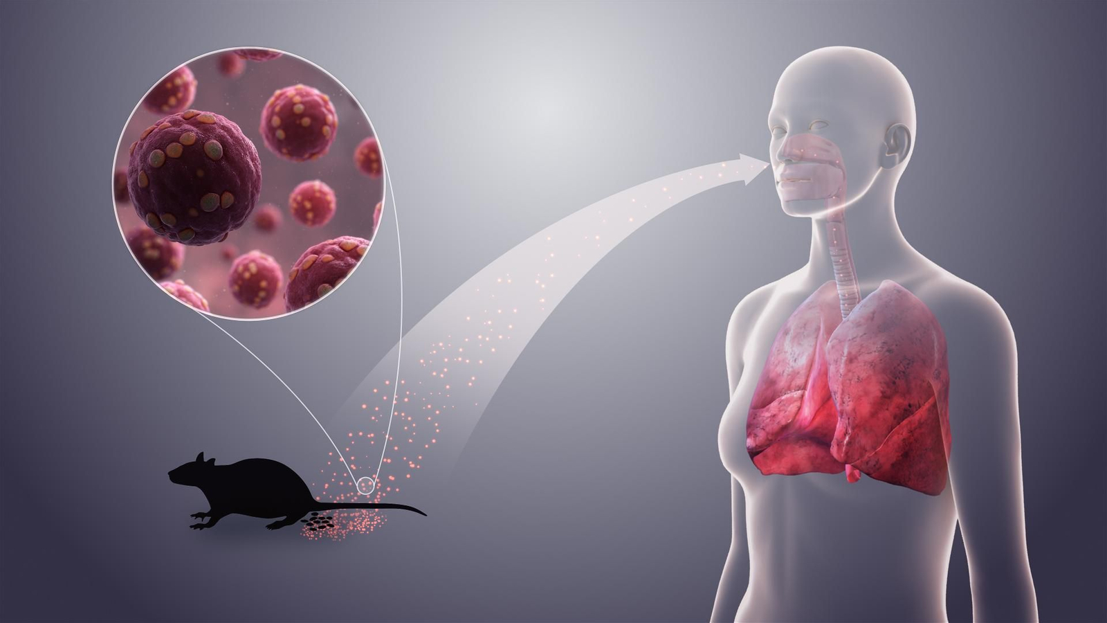 Hantavirus: conoce los detalles del virus