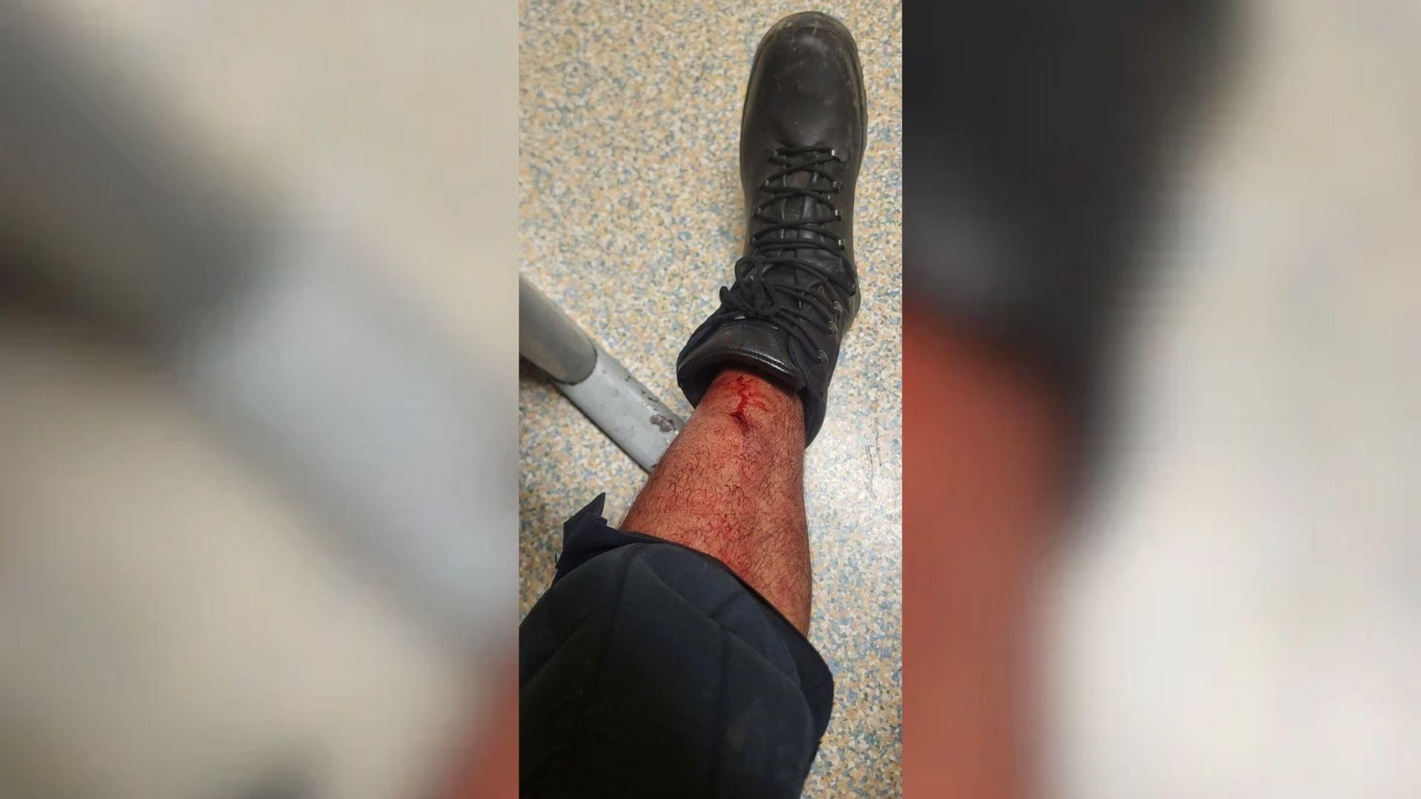 La herida de uno de los policías desplazados a Ceuta.