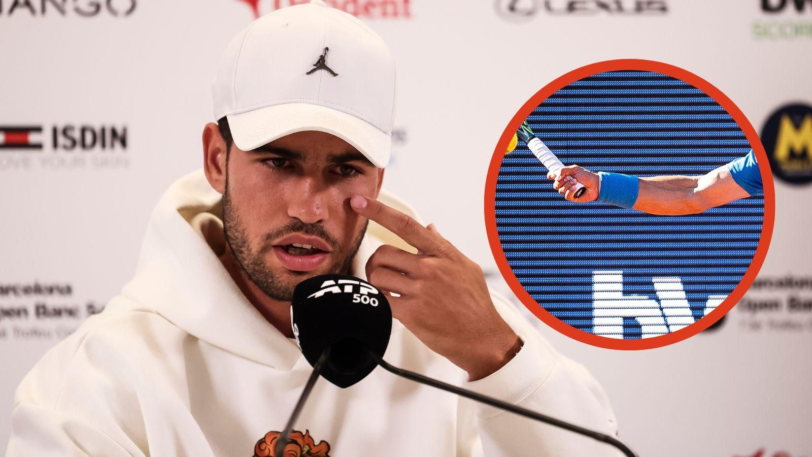 Carlos Alcaraz no jugará Roland Garros