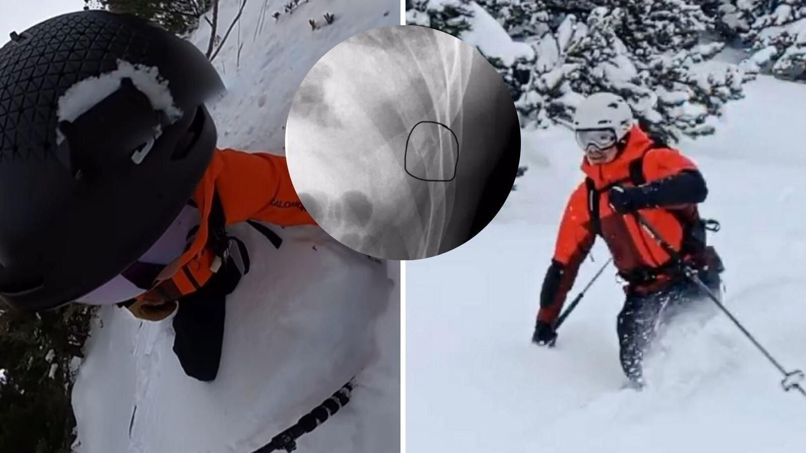 Accidente en esquí de Jorge Fernández.