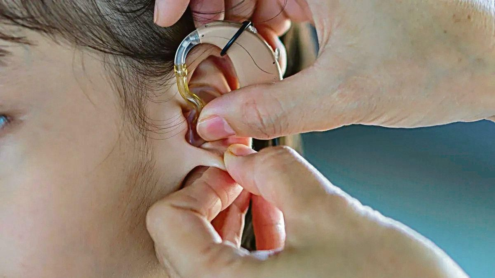 Colocación de un audífono a una joven con problemas de sordera.