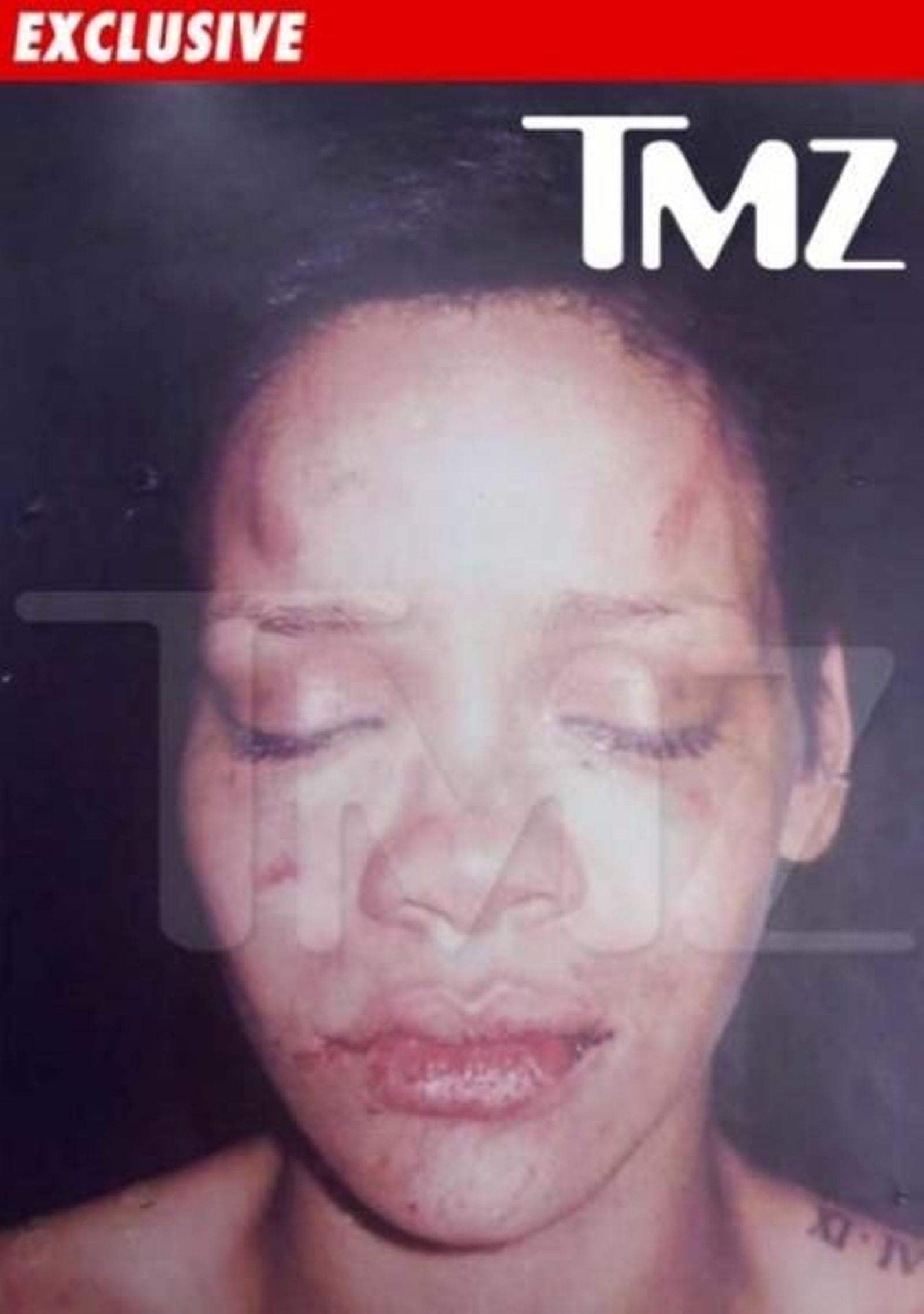 Imagen difundida por TMZ, supuestamente de la cantante Rihanna tras ser golpeada por Chris Brown.
