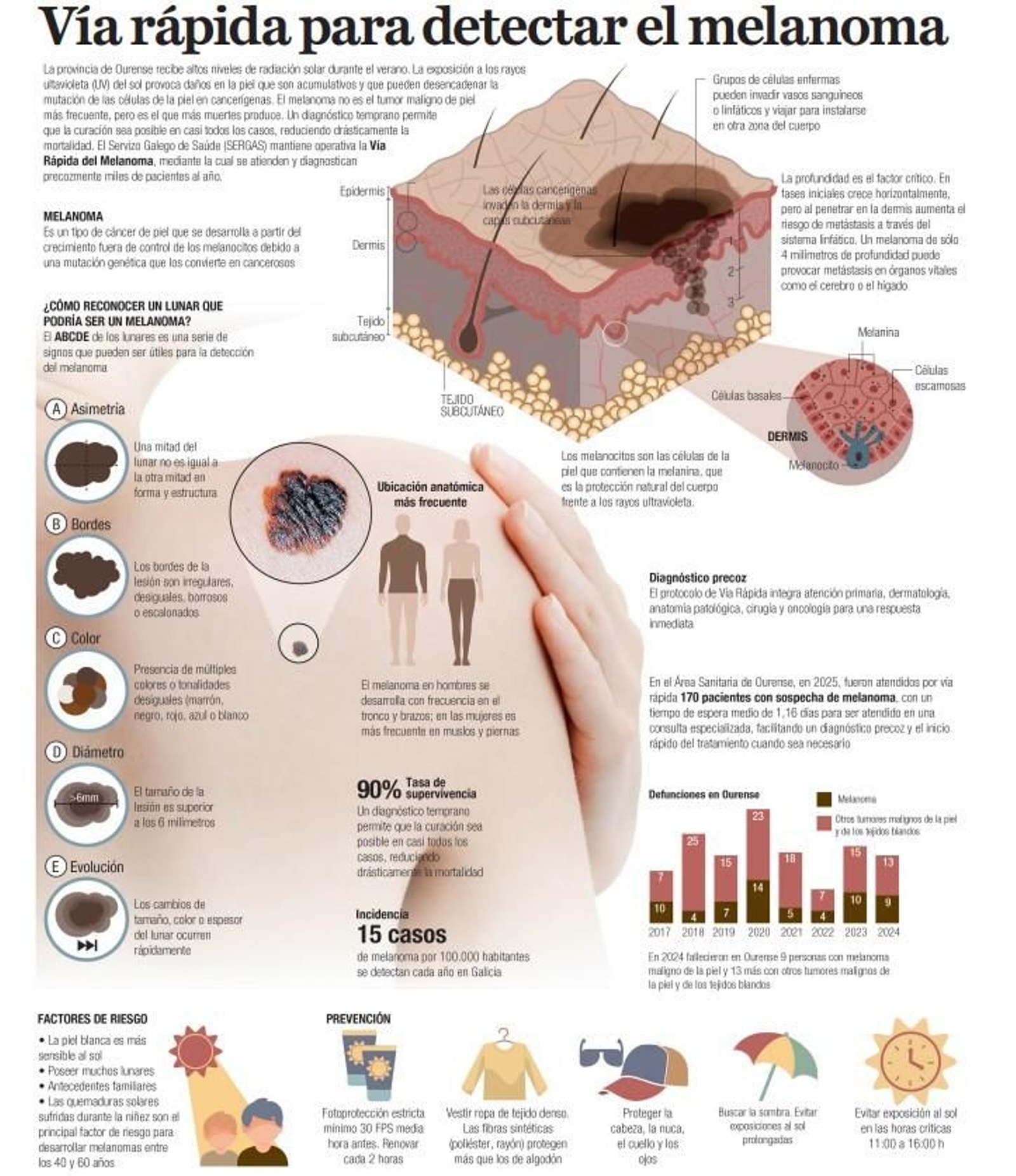 Infografía sobre la detección precoz del melanoma y el funcionamiento de la vía rápida sanitaria activada en Ourense para reducir los tiempos de diagnóstico.