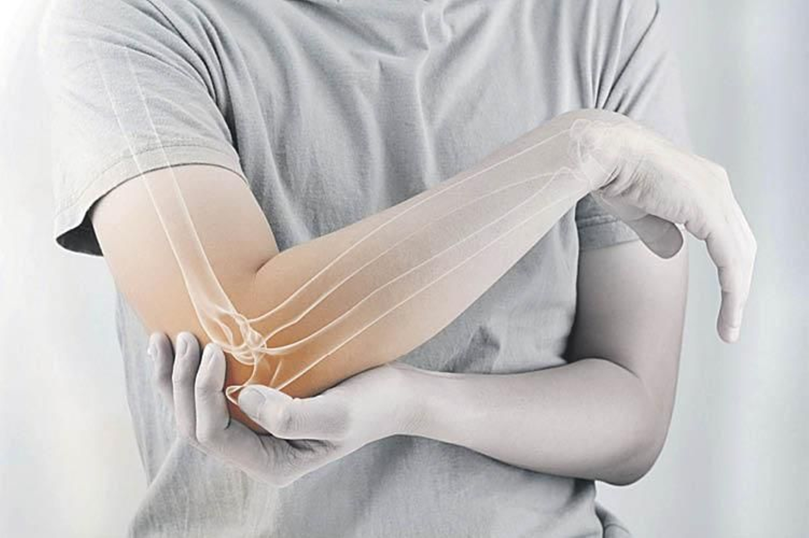 Una persona con osteoporosis en un codo.