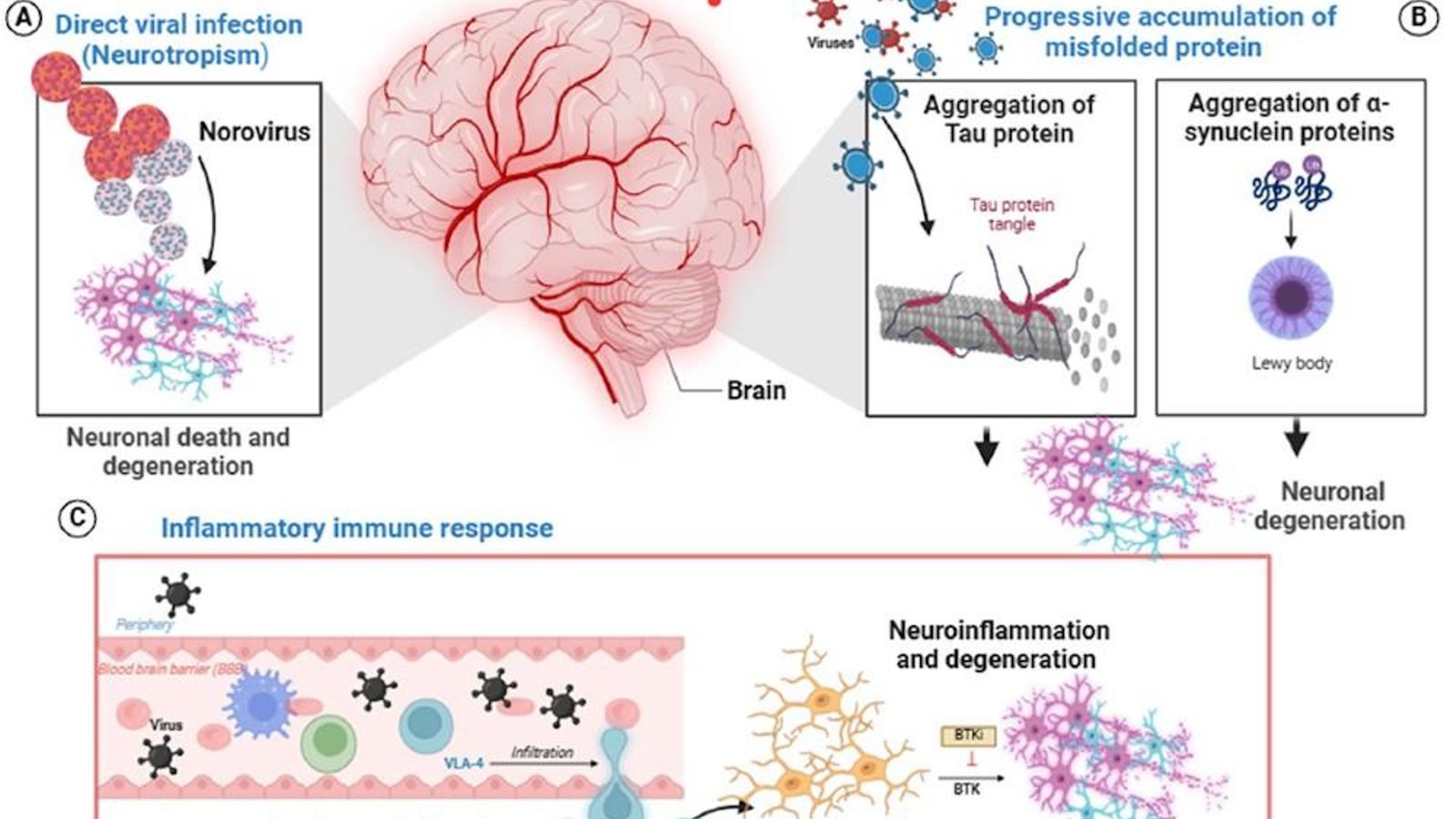 Mecanismos potenciales que vinculan la infección viral con enfermedades neurodegenerativas. Extraída de 'Viruses and neurodegeneration: a growing concern'.