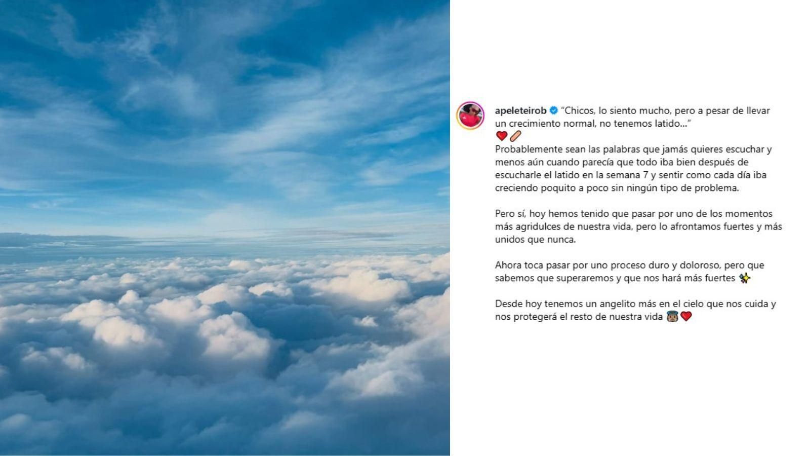 Comunicado de Ana Peleteiro en su cuenta de IG